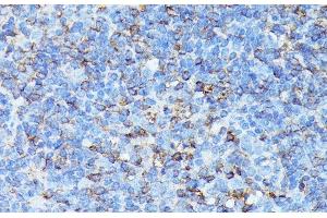 Immunohistochemistry of paraffin-embedded Mouse spleen using CXCR1 Polyclonal Antibody at dilution of 1:100 (40x lens). (CXCR1 anticorps)