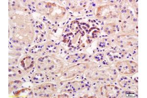 Formalin-fixed and paraffin embedded human kidney labeled with Rabbit Anti PEPT1 Polyclonal Antibody, Unconjugated (ABIN671961) at 1:200 followed by conjugation to the secondary antibody and DAB staining (SLC15A1 anticorps  (AA 101-200))