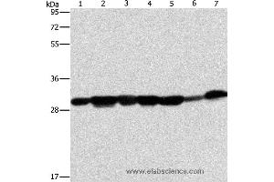 Western blot analysis of Human placenta tissue and A549 cell, mouse brain tissue and hepG2 cell, Raji cell and human fetal liver tissue, hela cell, using AK2 Polyclonal Antibody at dilution of 1:300 (Adenylate Kinase 2 anticorps)