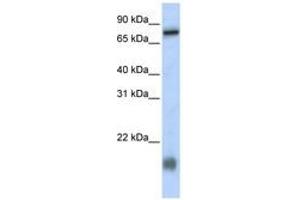 Image no. 1 for anti-Leber Congenital Amaurosis 5-Like (LCA5L) (N-Term) antibody (ABIN6740944) (LCA5L anticorps  (N-Term))