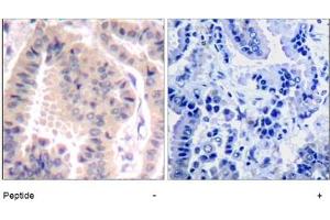 Image no. 1 for anti-Eukaryotic Translation Initiation Factor 4B (EIF4B) (AA 420-424) antibody (ABIN401568) (EIF4B anticorps  (AA 420-424))