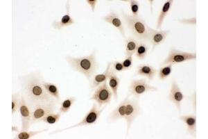 IHC testing of FFPE human breast cancer tissue with LMNB1 antibody. (Lamin B1 anticorps  (AA 266-583))