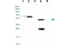 Western blot analysis of Lane 1: RT-4 Lane 2: U-251 MG Lane 3: Human Plasma Lane 4: Liver Lane 5: Tonsil with PPAN-P2RY11 polyclonal antibody . (PPAN anticorps)