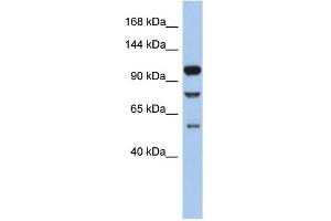 WB Suggested Anti-TLR9 Antibody Titration: 0. (TLR9 anticorps  (N-Term))