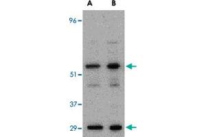 Western blot analysis of PDCD4 in A-20 cell lysate with PDCD4 polyclonal antibody  at (A) 0. (PDCD4 anticorps  (C-Term))