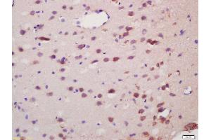 Formalin-fixed and paraffin embedded rat brain labeled with Anti-Spinophilin/Neurabin 2 Polyclonal Antibody, Unconjugated (ABIN1386710) at 1:200 followed by conjugation to the secondary antibody and DAB staining (PPP1R9B anticorps  (AA 358-460))