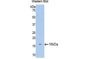 Detection of Recombinant AGC, Mouse using Polyclonal Antibody to Aggrecan (AGC) (Aggrecan anticorps  (AA 34-147))
