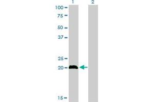 Western Blot analysis of CITED1 expression in transfected 293T cell line by CITED1 monoclonal antibody (M01), clone 6G8.