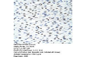 Human Heart (TARDBP anticorps  (C-Term))