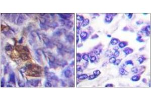 Immunohistochemistry analysis of paraffin-embedded human pancreas tissue, using MSK1 (Ab-360) Antibody. (MSK1 anticorps  (AA 331-380))