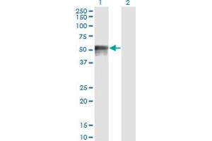 Western Blot analysis of FOXA1 expression in transfected 293T cell line by FOXA1 monoclonal antibody (M02), clone 1B1.