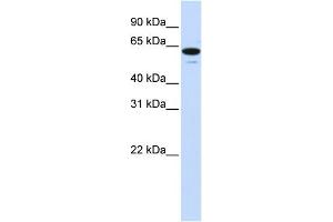 WB Suggested Anti-ZNF655 Antibody Titration:  0. (ZNF655 anticorps  (Middle Region))