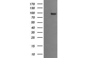 Image no. 1 for anti-Phosphoinositide-3-Kinase, Regulatory Subunit 5 (PIK3R5) antibody (ABIN1500218) (PIK3R5 anticorps)
