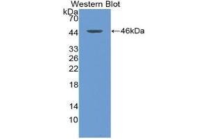 Western blot analysis of the recombinant protein. (Thymic Stromal Lymphopoietin anticorps  (AA 21-138))