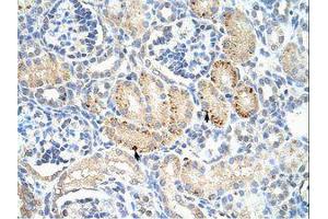 anti-Frizzled Family Receptor 7 (FZD7) (C-Term) antibody