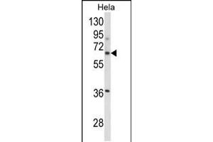 Western blot analysis of ITGBL1 Antibody in Hela cell line lysates (35ug/lane) (ITGBL1 anticorps  (AA 334-360))