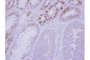 Image no. 1 for anti-Glucokinase (Hexokinase 4) Regulator (GCKR) (AA 1-214) antibody (ABIN1501890)