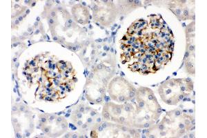 Nestin was detected in paraffin-embedded sections of rat kidney tissues using rabbit anti- Nestin Antigen Affinity purified polyclonal antibody at 1 μg/mL.