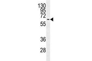 MAPK15 antibody western blot analysis in MCF-7 lysate.