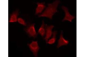 ABIN6276084 staining HeLa by IF/ICC. (OR51G2 anticorps  (Internal Region))