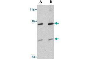 Western blot analysis of TMC8 in Jurkat cell lysate with TMC8 polyclonal antibody  at (A) 1 and (B) 2 ug/mL .