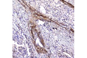 IHC analysis of Serum Amyloid P using anti-Serum Amyloid P antibody .