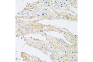 Immunohistochemistry of paraffin-embedded mouse heart using NAT8B antibody at dilution of 1:200 (40x lens). (NAT8B anticorps)