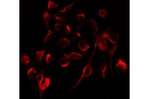 ABIN6267299 staining HepG2 by IF/ICC. (Integrin beta 3 anticorps  (pTyr773))