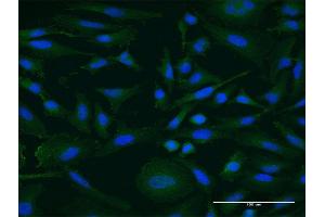 Immunofluorescence of monoclonal antibody to IGDCC4 on HeLa cell. (IGDCC4 anticorps  (AA 1152-1250))
