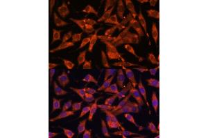 Immunofluorescence analysis of L929 cells using MT-ND1 Polyclonal Antibody (ABIN7268598) at dilution of 1:100 (40x lens).