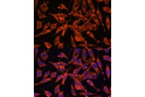Immunofluorescence analysis of L929 cells using MT-ND1 Polyclonal Antibody (ABIN7268598) at dilution of 1:100 (40x lens). (MT-ND1 anticorps)