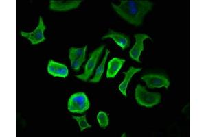 Immunofluorescence staining of MCF-7 cells with ABIN7148132 at 1:166, counter-stained with DAPI.