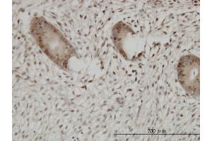 Immunoperoxidase of monoclonal antibody to UHRF1 on formalin-fixed paraffin-embedded human endometrium.