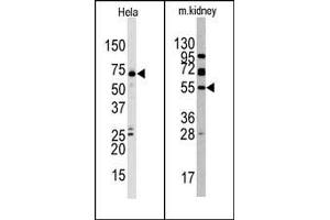 Image no. 1 for anti-Jumonji Domain Containing 4 (JMJD4) (C-Term) antibody (ABIN356562) (JMJD4 anticorps  (C-Term))