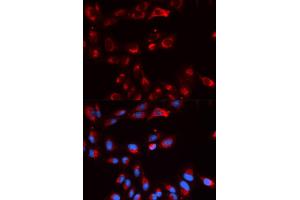 Immunofluorescence analysis of U2OS cells using CFP antibody (ABIN5973127). (CFP anticorps)