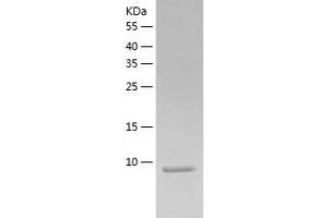 Western Blotting (WB) image for WW Domain Binding Protein 2 (WBP2) (AA 1-100) protein (His-IF2DI Tag) (ABIN7125746)