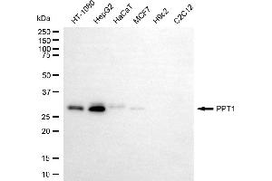 Western blotting analysis using PPT1 antibody (ABIN7799730).