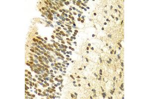 Immunohistochemistry of paraffin-embedded Human embryo brain using MYSM1 antibody at dilution of 1:100 (x400 lens). (MYSM1 anticorps  (C-Term))