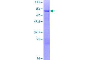 Image no. 1 for Interferon Regulatory Factor 8 (IRF8) (AA 1-426) protein (GST tag) (ABIN1308098)