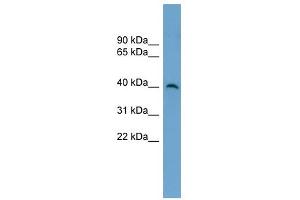 SUV39H2 antibody used at 1 ug/ml to detect target protein. (SUV39H2 anticorps)