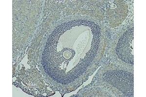 Expression of GnRHR in rat ovaryImmunohistochemical staining of rat ovary paraffin-embedded sections using Anti-GnRH Receptor (extracellular) Antibody (ABIN7043262 and ABIN7044416). (Gonadotropin-Releasing Hormone Receptor (GNRHR) Peptide)