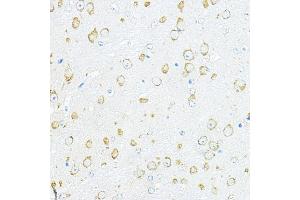 Immunohistochemistry of paraffin-embedded mouse brain using RPL10A Rabbit pAb (ABIN6129099, ABIN6147103, ABIN6147104 and ABIN6221624) at dilution of 1:100 (40x lens).