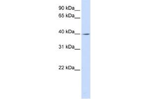 WB Suggested Anti-LRRC28 Antibody Titration: 0. (LRRC28 anticorps  (C-Term))