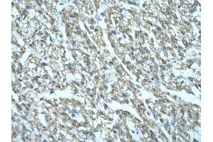 Rabbit Anti-FGD1 Antibody Catalog Number: ARP31673  Paraffin Embedded Tissue: Human cardiac cell  Cellular Data: Epithelial cells of renal tubule Antibody Concentration:  4. (FGD1 anticorps  (C-Term))