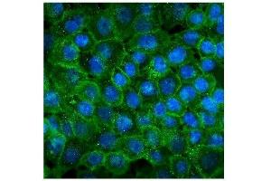 IF analysis of P cadherin using anti-P cadherin antibody (ABIN7599888). (P-Cadherin anticorps  (AA 126-336))