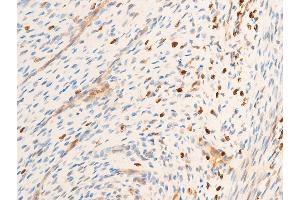 ABIN6267071 at 1/100 staining rat uterine tissue sections by IHC-P.