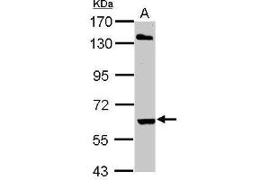 ARIH2 anticorps  (C-Term)