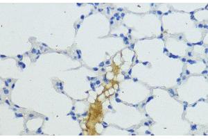 Immunohistochemistry of paraffin-embedded Mouse lung using KLKB1 Polyclonal Antibody at dilution of 1:200 (40x lens).