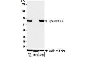 Western Blotting (WB) image for anti-Keratin 5 (KRT5) (C-Term) antibody (ABIN7795755)