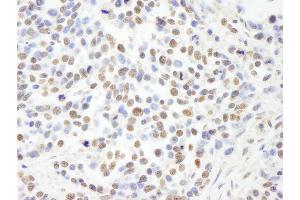 Immunohistochemistry (IHC) image for anti-Retinoblastoma Binding Protein 4 (RBBP4) (AA 1-50) antibody (ABIN7448756)